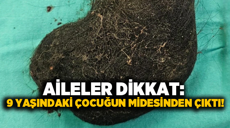 Aileler dikkat: 9 yaşındaki çocuğun midesinden çıktı!