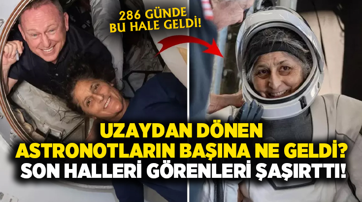 Uzaydan dönen Astronotların başına ne geldi? Son halleri görenleri şaşırttı!
