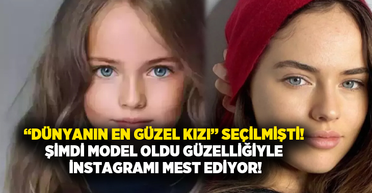 “Dünyanın en güzel kızı” seçilmişti! Şimdi güzelliğiyle instagramı mest ediyor!