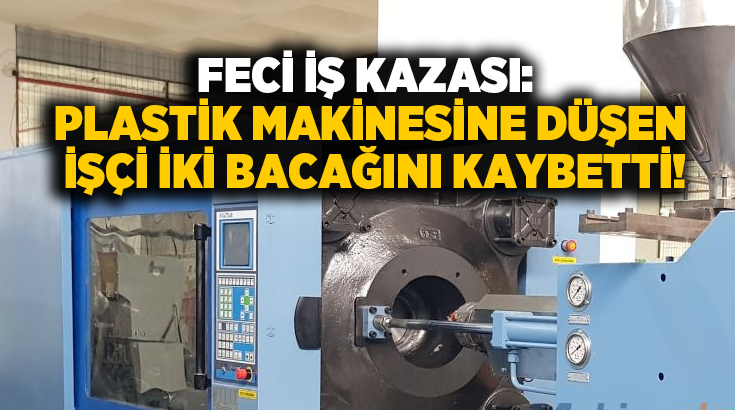 Feci iş kazası: Plastik makinesine düşen işçi iki bacağını kaybetti!