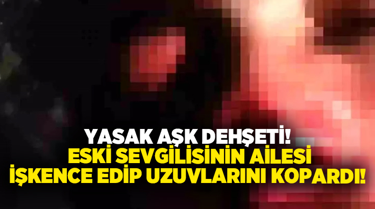 Yasak aşk dehşeti! Eski sevgilisinin ailesi işkence edip uzuvlarını kopardı!
