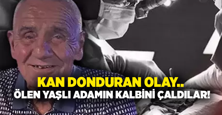 Kan donduran olay.. Ölen yaşlı adamın kalbini çaldılar!