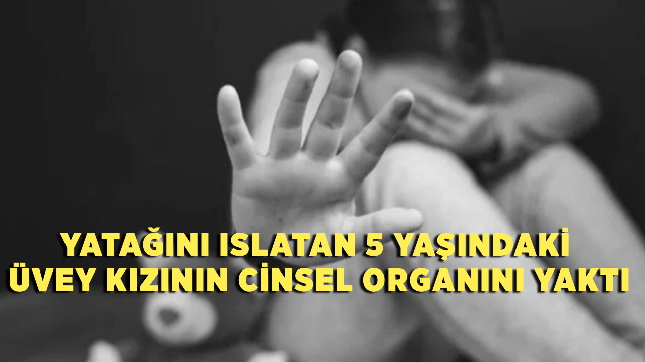 Yatağını ıslatan 5 yaşındaki üvey kızının cinsel organını yaktı