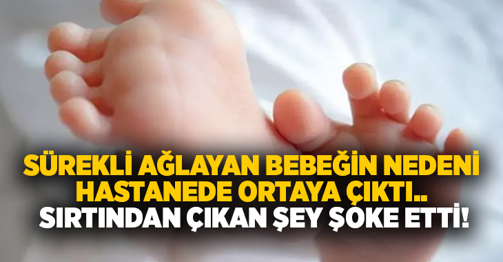 Sürekli ağlayan bebeğin nedeni hastanede ortaya çıktı.. Sırtından çıkan şey şoke etti!