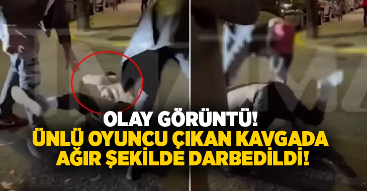 Olay görüntü! Ünlü oyuncu çıkan kavgada ağır şekilde darbedildi!