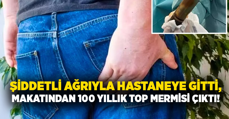 Şiddetli ağrıyla hastaneye gitti, makatından 100 yıllık top mermisi çıktı!