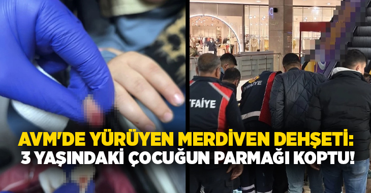 AVM’de yürüyen merdiven dehşeti: 3 yaşındaki çocuğun parmağı koptu!