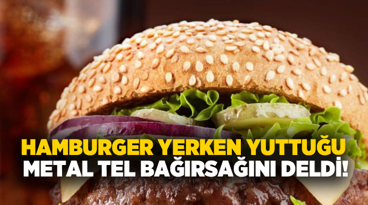Hamburger yerken yuttuğu metal tel bağırsağını deldi!